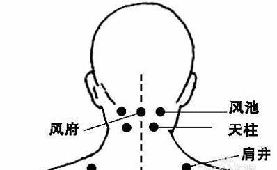 落枕了应该怎么办？有哪些需要注意的问题？